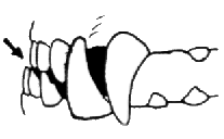 Prognatismo